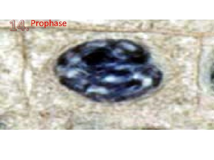 14. Prophase 