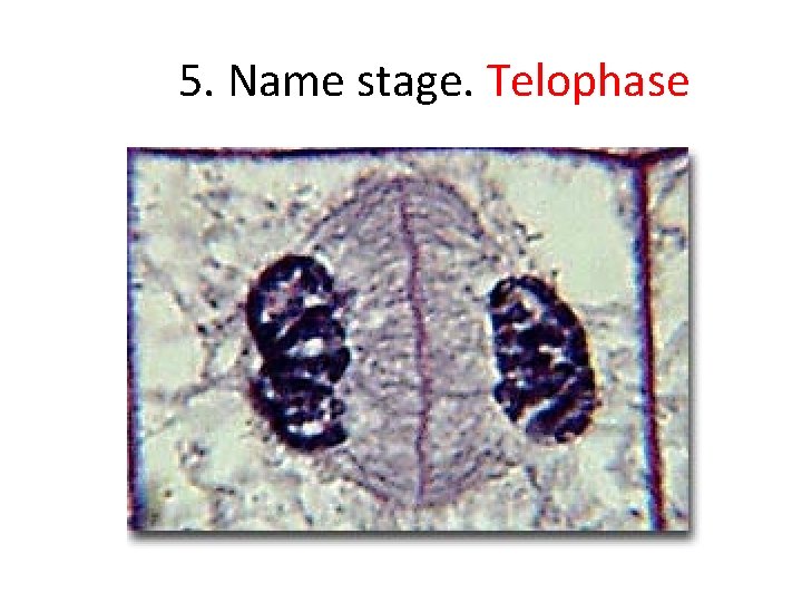 5. Name stage. Telophase 