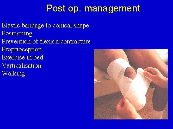 Post op. management Elastic bandage to conical shape Positioning Prevention of flexion contracture Proprioception