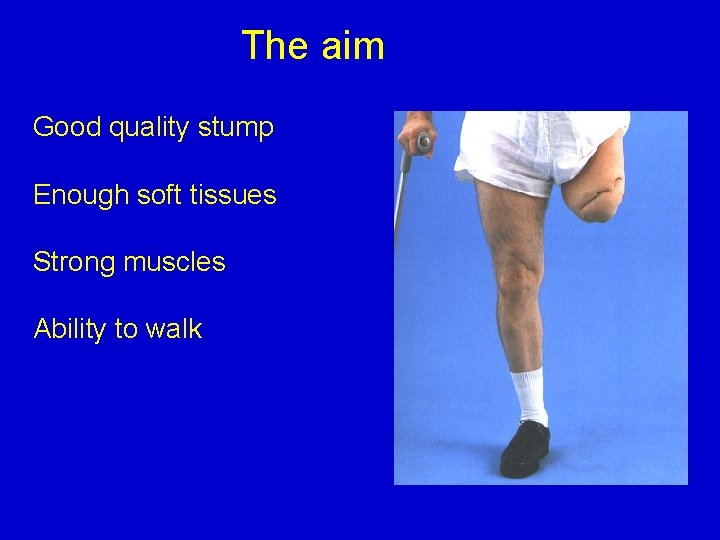The aim Good quality stump Enough soft tissues Strong muscles Ability to walk 