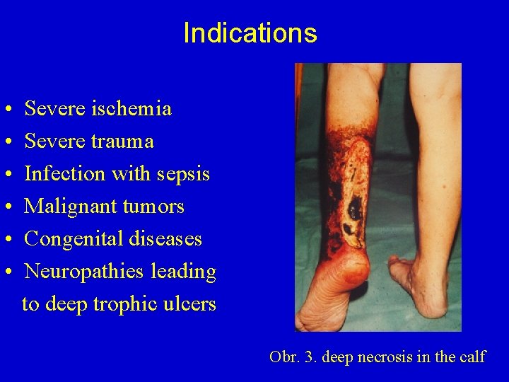 Indications • • • Severe ischemia Severe trauma Infection with sepsis Malignant tumors Congenital