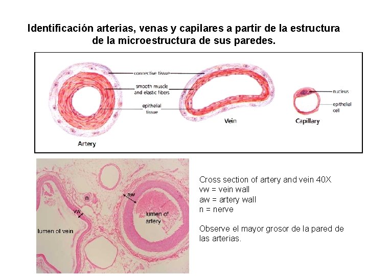 Identificación arterias, venas y capilares a partir de la estructura de la microestructura de