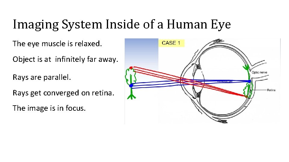 Imaging System Inside of a Human Eye The eye muscle is relaxed. Object is