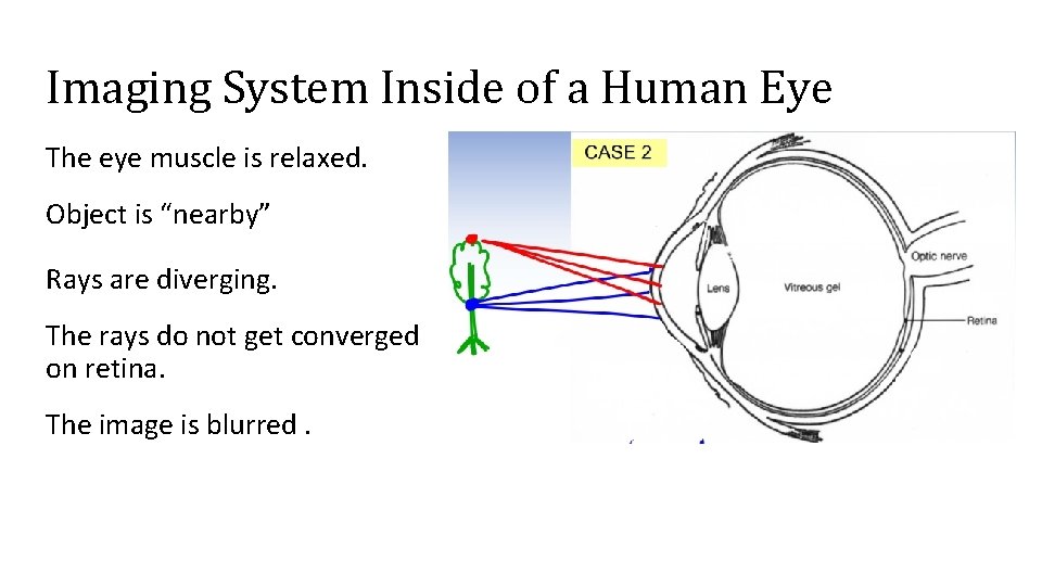 Imaging System Inside of a Human Eye The eye muscle is relaxed. Object is
