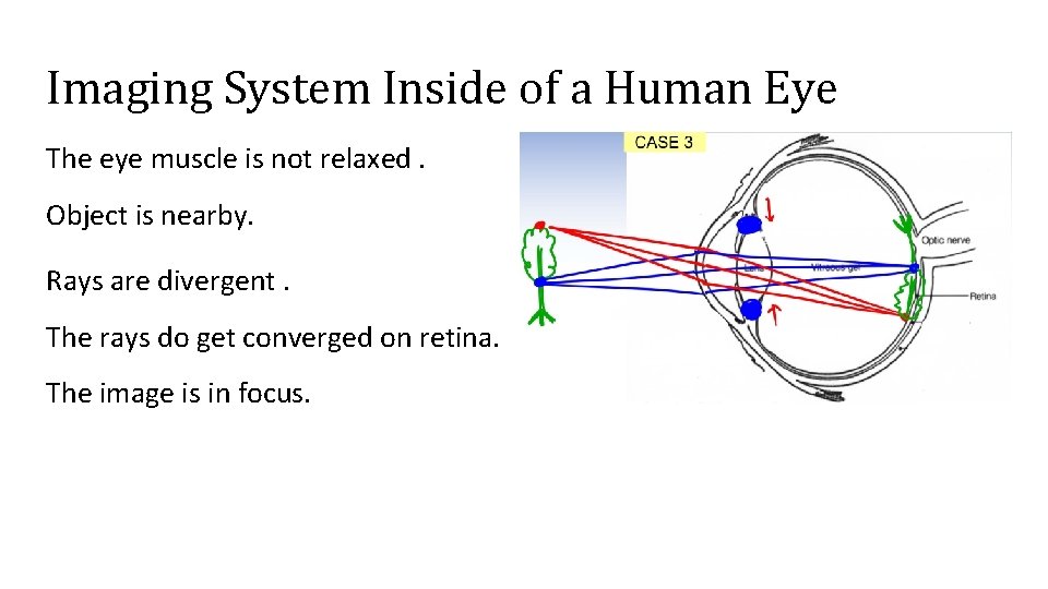 Imaging System Inside of a Human Eye The eye muscle is not relaxed. Object