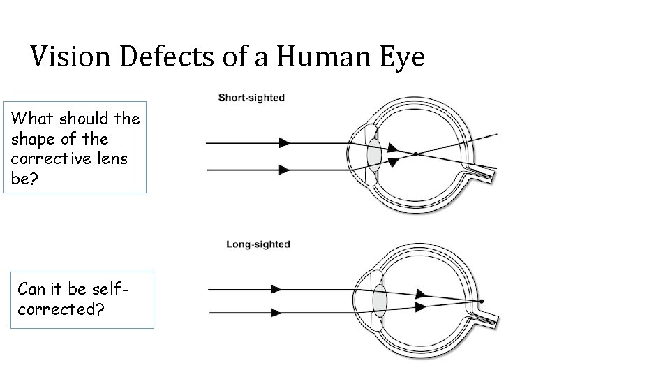 Vision Defects of a Human Eye What should the shape of the corrective lens
