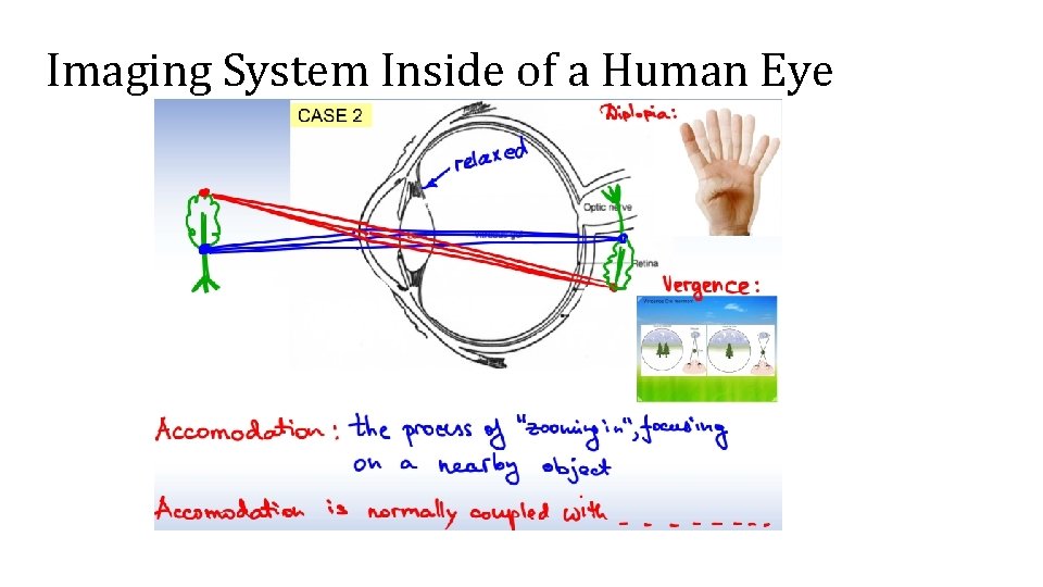 Imaging System Inside of a Human Eye 