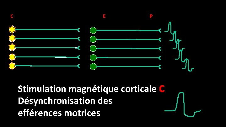 C E P Stimulation magnétique corticale C Désynchronisation des efférences motrices 
