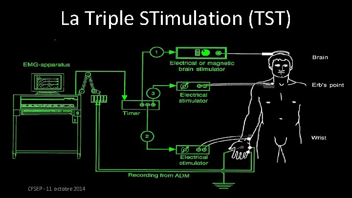 La Triple STimulation (TST) CFSEP - 11 octobre 2014 