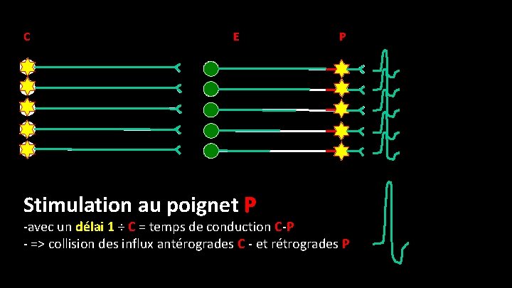 C E Stimulation au poignet P P -avec un délai 1 ÷ C =