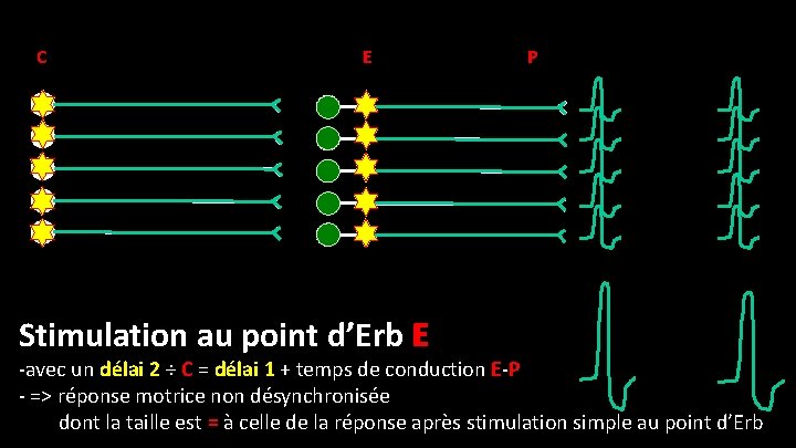 C E Stimulation au point d’Erb E P -avec un délai 2 ÷ C