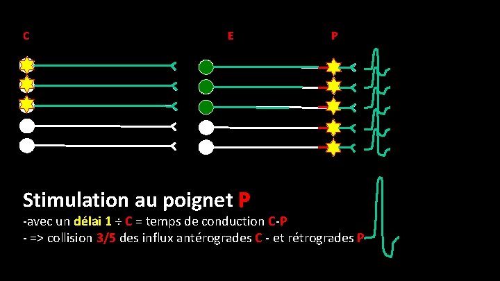 C E Stimulation au poignet P P -avec un délai 1 ÷ C =