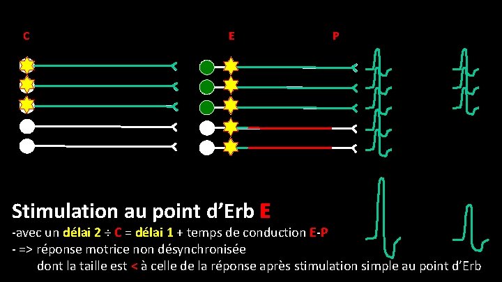 C E Stimulation au point d’Erb E P -avec un délai 2 ÷ C