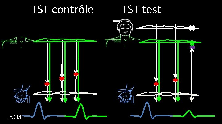 TST contrôle ADM TST test 