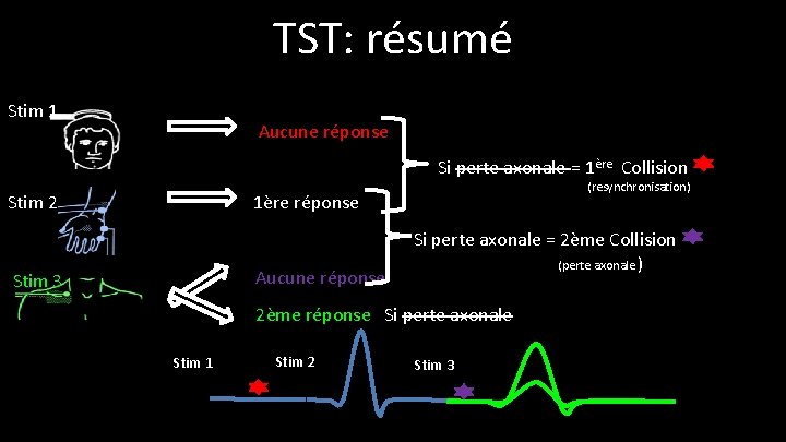 TST: résumé Stim 1 Aucune réponse Si perte axonale = 1ère Collision Stim 2