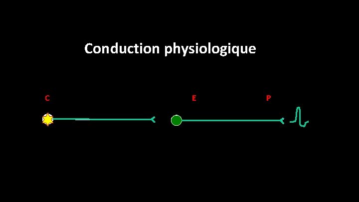 Conduction physiologique C E P 