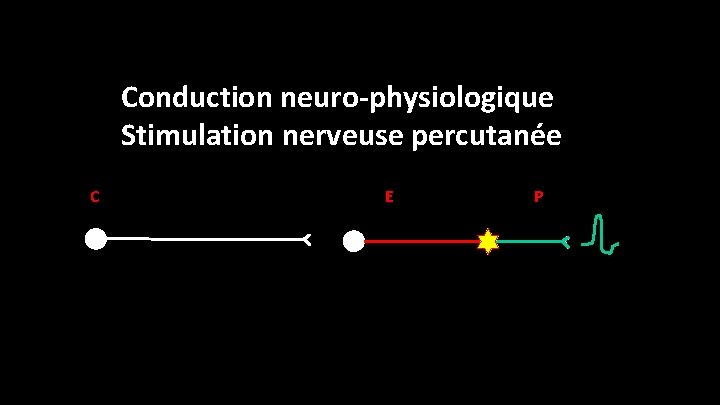 Conduction neuro-physiologique Stimulation nerveuse percutanée C E P 