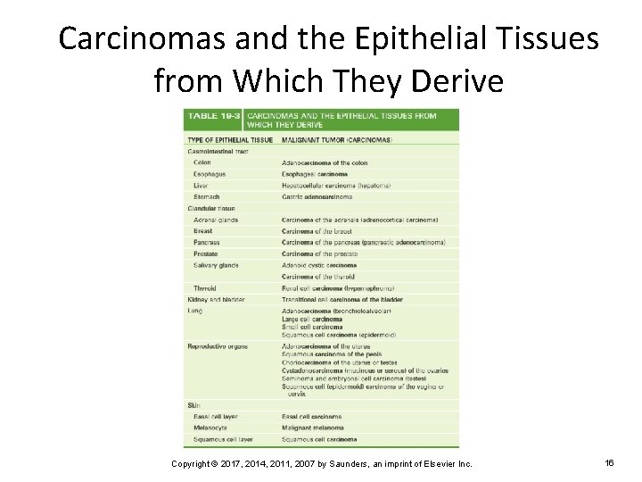 Carcinomas and the Epithelial Tissues from Which They Derive Copyright © 2017, 2014, 2011,