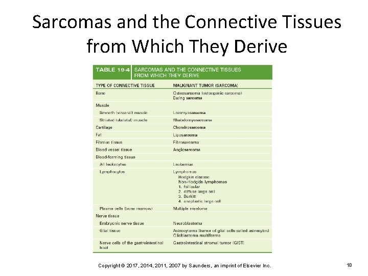 Sarcomas and the Connective Tissues from Which They Derive Copyright © 2017, 2014, 2011,