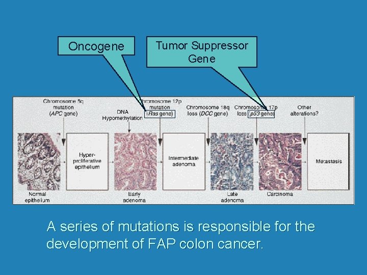 Oncogene Tumor Suppressor Gene A series of mutations is responsible for the development of