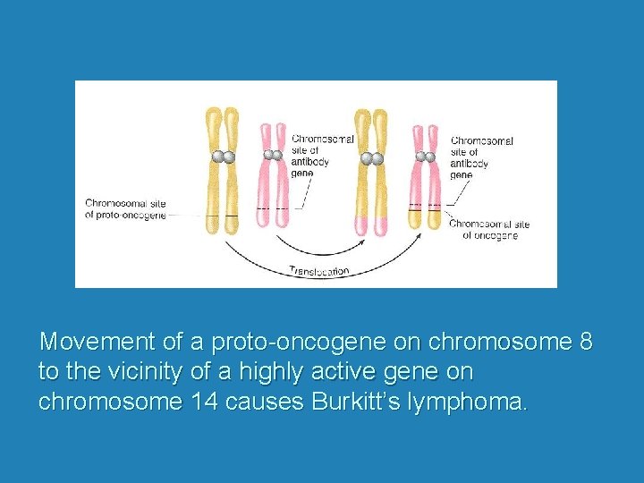 Movement of a proto-oncogene on chromosome 8 to the vicinity of a highly active