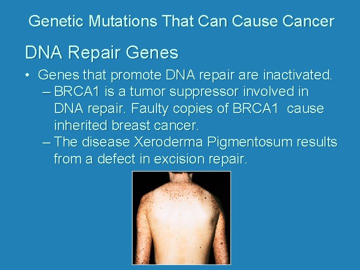 Genetic Mutations That Can Cause Cancer DNA Repair Genes • Genes that promote DNA