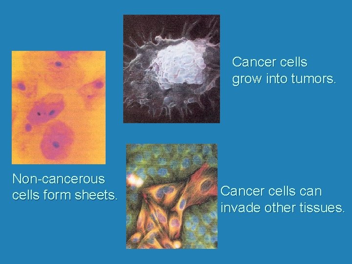 Cancer cells grow into tumors. Non-cancerous cells form sheets. Cancer cells can invade other