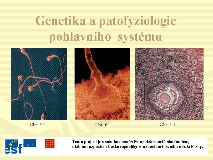 Genetika a patofyziologie pohlavního systému Obr. č. 1 Obr. č. 2 Obr. č. 3