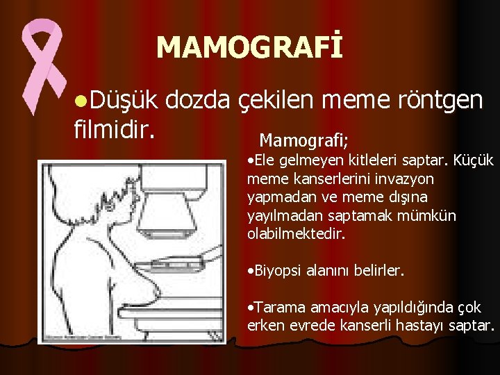 MAMOGRAFİ l. Düşük filmidir. dozda çekilen meme röntgen Mamografi; • Ele gelmeyen kitleleri saptar.