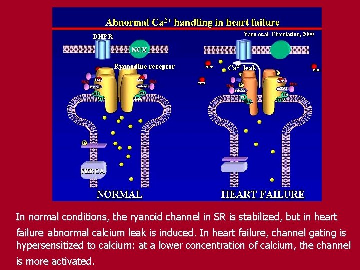 In normal conditions, the ryanoid channel in SR is stabilized, but in heart failure