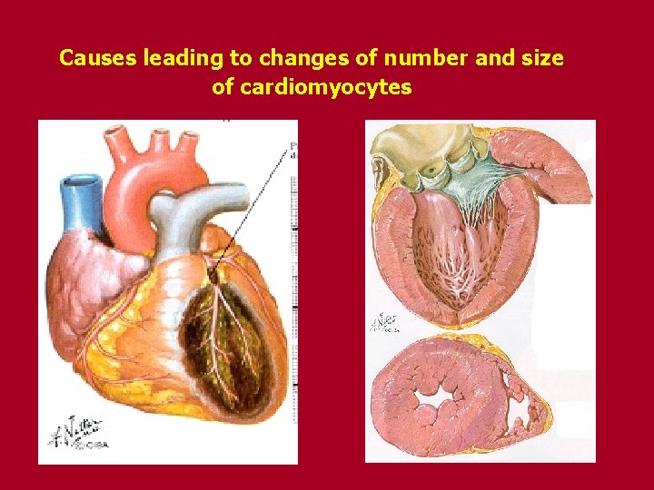 Causes leading to changes of number and size of cardiomyocytes 