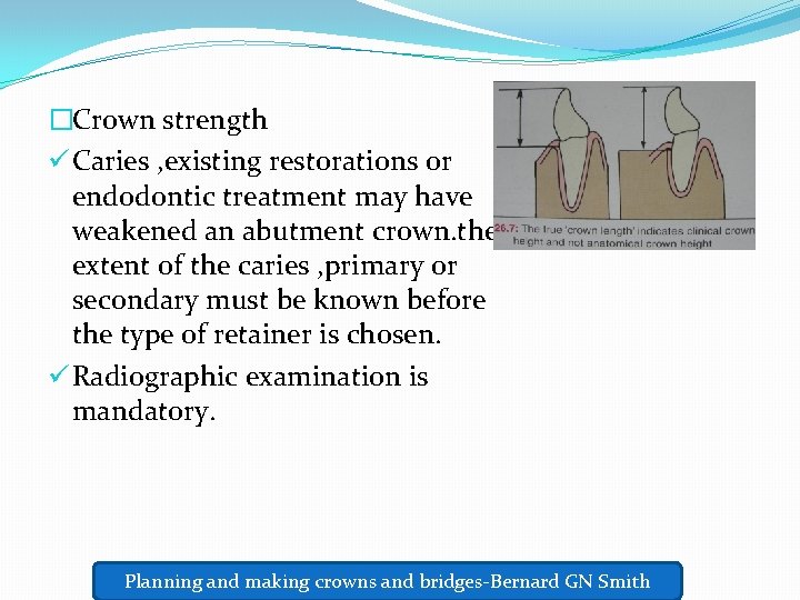 �Crown strength ü Caries , existing restorations or endodontic treatment may have weakened an