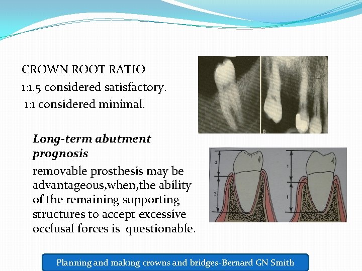 CROWN ROOT RATIO 1: 1. 5 considered satisfactory. 1: 1 considered minimal. Long-term abutment