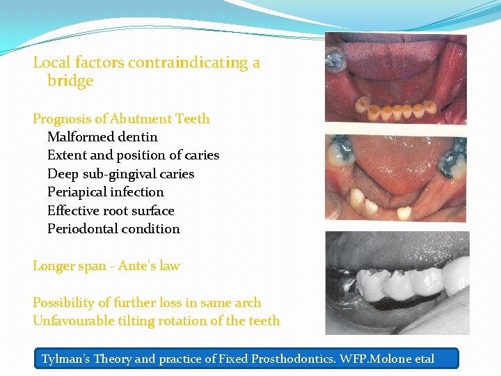 Local factors contraindicating a bridge Prognosis of Abutment Teeth Malformed dentin Extent and position