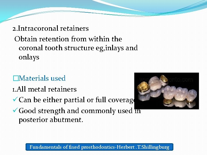 2. Intracoronal retainers Obtain retention from within the coronal tooth structure eg, inlays and