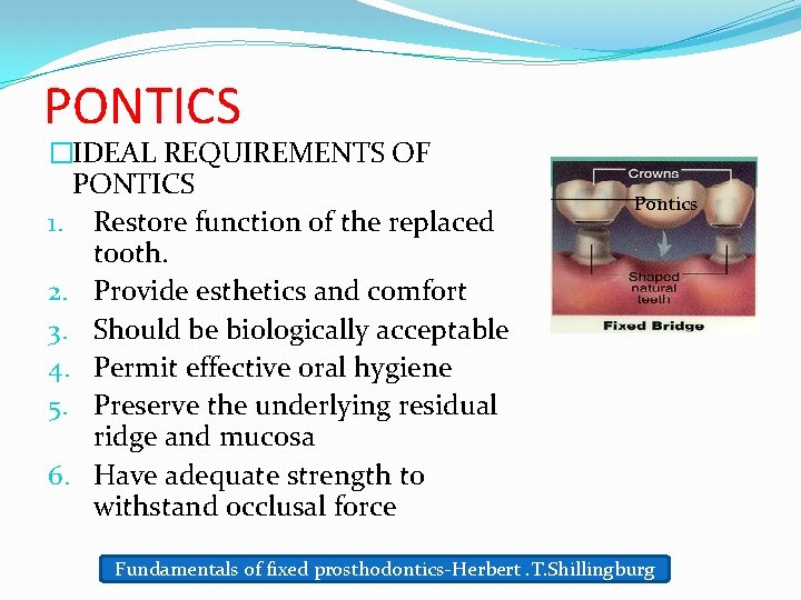 PONTICS �IDEAL REQUIREMENTS OF PONTICS 1. Restore function of the replaced tooth. 2. Provide
