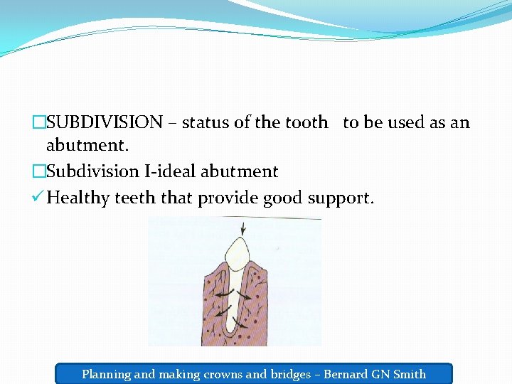�SUBDIVISION – status of the tooth to be used as an abutment. �Subdivision I-ideal
