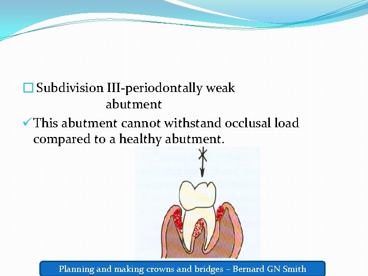 � Subdivision III-periodontally weak abutment ü This abutment cannot withstand occlusal load compared to