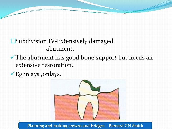 �Subdivision IV-Extensively damaged abutment. ü The abutment has good bone support but needs an