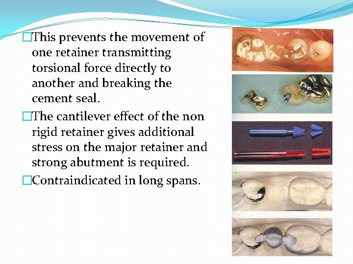 �This prevents the movement of one retainer transmitting torsional force directly to another and