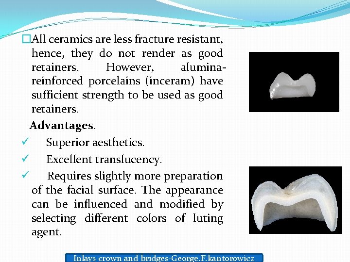 �All ceramics are less fracture resistant, hence, they do not render as good retainers.