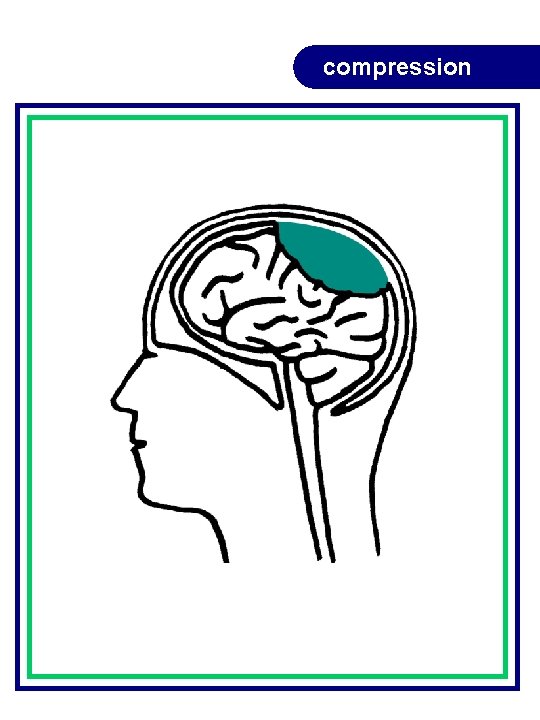 compression compression