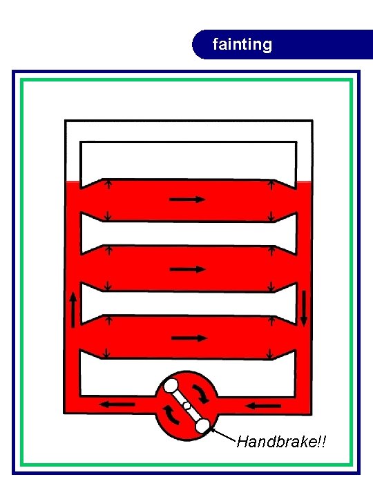 fainting Handbrake!! fainting Handbrake!!