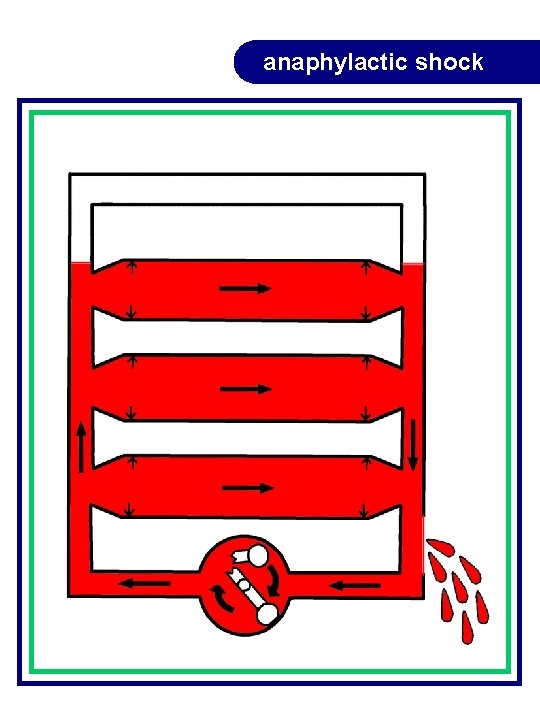 anaphylactic shock anaphylactic shock