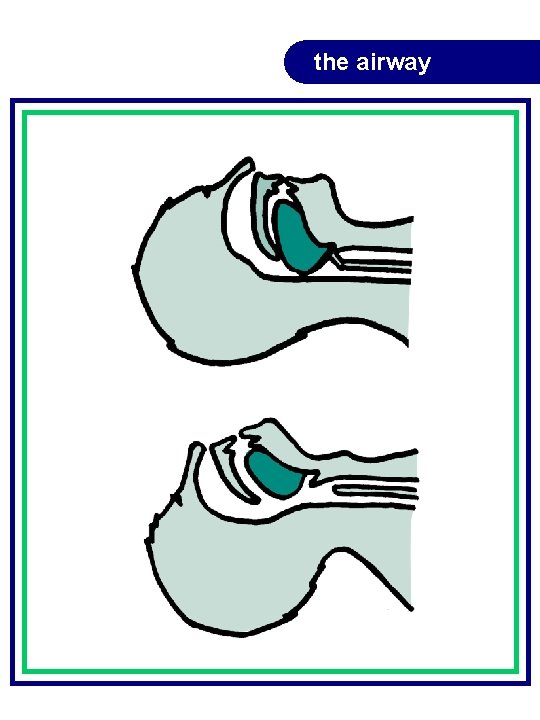 the airway the airway