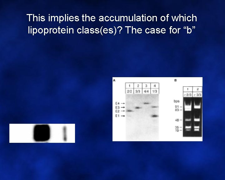  This implies the accumulation of which lipoprotein class(es)? The case for “b” 