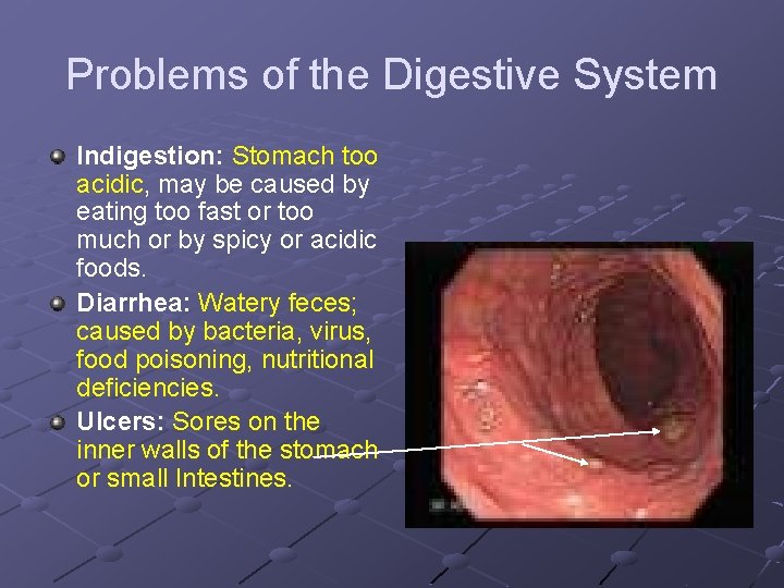 Problems of the Digestive System Indigestion: Stomach too acidic, may be caused by eating