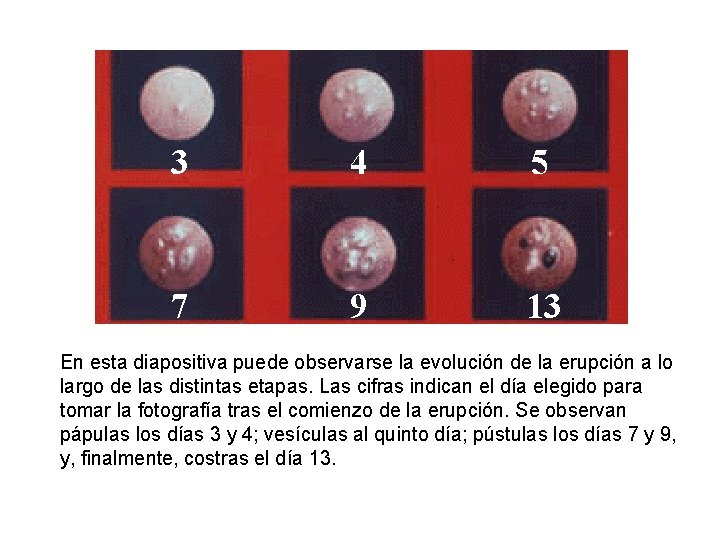 3 4 5 7 9 13 En esta diapositiva puede observarse la evolución de