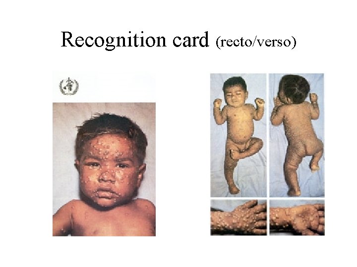 Recognition card (recto/verso) 