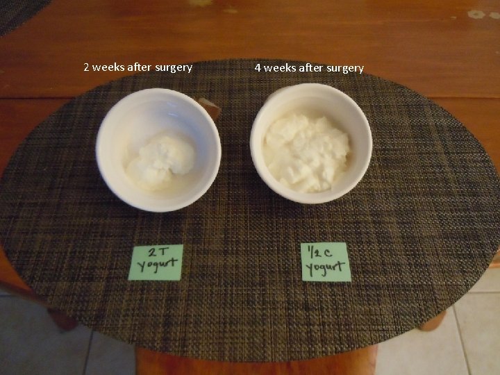 2 weeks after surgery 4 weeks after surgery 